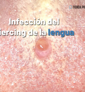 infeccion piercing lengua