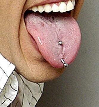 infeccion piercing lengua